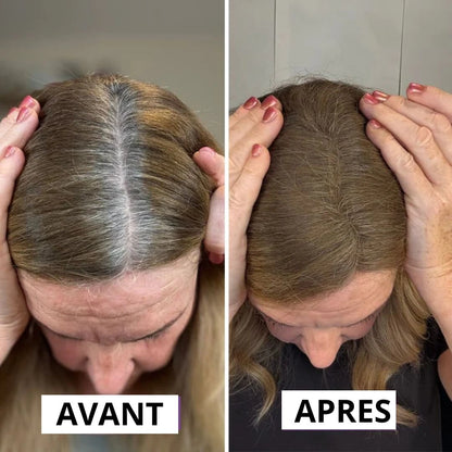 Vos racines se voient