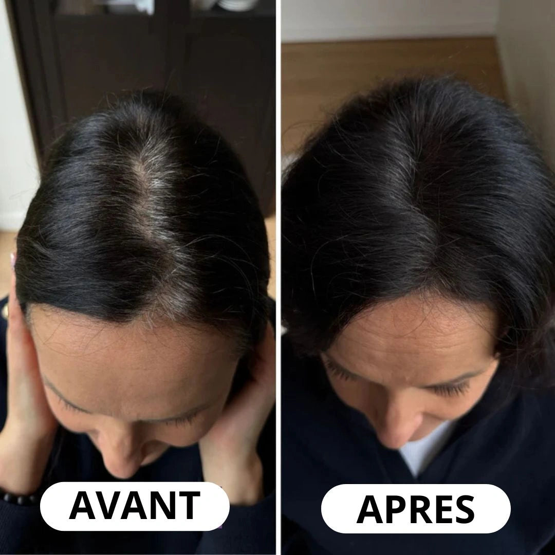 Vos racines se voient