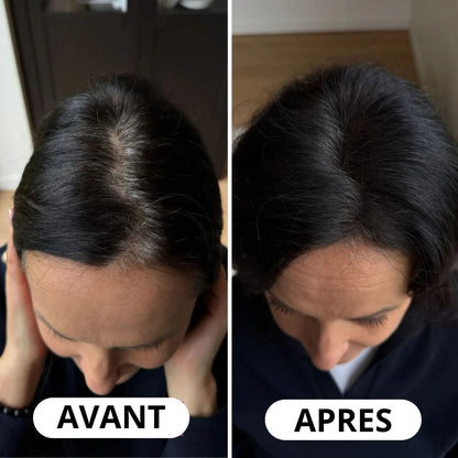 Vos racines se voient