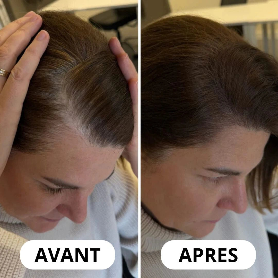 Vos racines se voient